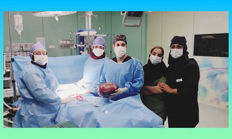  عمل جراحی توده با ابعاد 10در15داخل شکم خانم 82 ساله